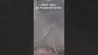 Wie sieht eigentlich eine Faszie aus?