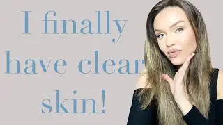 This Got Rid Of My Breakouts in ONE MONTH! Dermatica 1 Month Update!