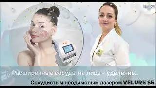 Удаление сосудов на лице