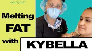 How To: Erase a Double Chin w/ Kybella