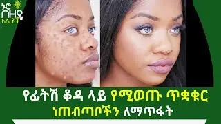 የፊትሽ ቆዳ ላይ የሚወጡ ጥቋቁር ነጠብጣቦችን ለማጥፋት የሚረዱሽ የቤት ውስጥ መላዎች