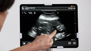 Fetal Abdominal Circumference