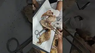 Demonstration of Urinary Bladder | mbbs #mbbs #mbbsstudent #mbbslife #shorts #short #viralvideo