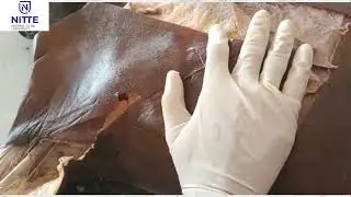 Video on demonstration of axilla boundaries