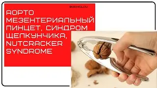 Аортомезентериальный пинцет, синдром щелкунчика, Nutcracker syndrome На УЗИ