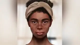ASMR #asmr problem skin😪#problemskin😩😩💩💩💩