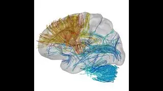 QEEG Brain Connectivity Mapping