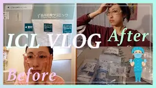 痛みに弱い私がICL手術受けてきた [Surgery VLOG]