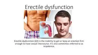 New device for Erectile dysfunction- Phallimax