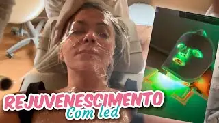 FotoAge: Rejuvenescimento com LED!