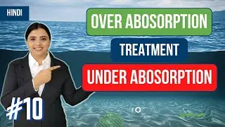 Treatment of Under/ (Over) Absorption of Overheads | CA Inter | Costing Capsules (Nov, 2023)