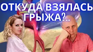 Почему появляются грыжи дисков, если позвоночник прочный?