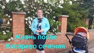 Жизнь после кесарева сечения. Мой личный опыт. Жду ваших советов