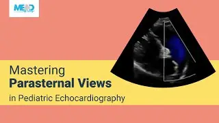 Mastering Parasternal Views in Pediatric Echocardiography