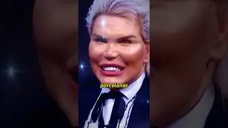 Ken humano e seus dentes frágeis. 