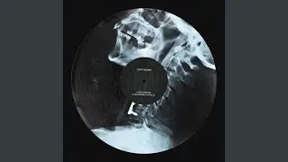 Steelyard