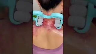 Product Link in Bio( #1042） ▶️ Six-wheel neck massager