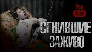 СГНИВШИЕ ЗА ЖИВО - Страшные истории на ночь. Страшилки на ночь.