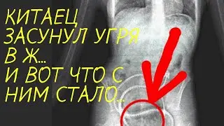Китаец засунул в себя угря | Истории из жизни - жизненные истории - интересные истории из жизни