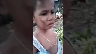 binanga ng aso ang bunso kung anak  4yrs old p cya nito 2018