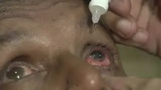 Brighten their sight by giving your zakat to ERWO
