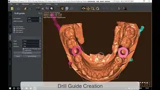 QuickVision 3D Tutorials - Creating a surgical guide