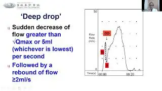 Non invasive urodynamics in children  Uroflowmetry and PVR by Stephen Shei  Dei yang