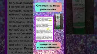 Отечность на ногах уменьшилась