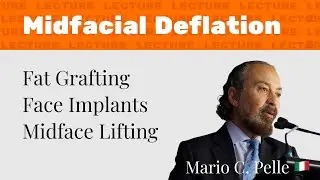 Lecture: Midfacial Deflation, Mario C. Pelle 🇮🇹 [english]