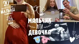 ВТОРОЙ СКРИНИНГ🥰УЗНАЁМ ПОЛ РЕБЁНКА🩷💙20 НЕДЕЛЬ БЕРЕМЕННОСТИ💫