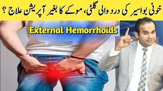 External Haemorrhoids | بواسیر میں درد والا موکا | Surgeon Dr Imtiaz Hussain