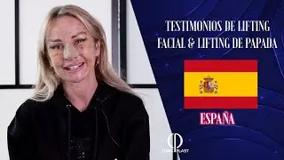 Testimonios de lifting facial & lifting de papada - Espana - Dr. Salih Onur Basat