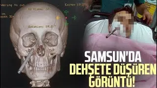 Samsun'da dehşete düşüren görüntü!