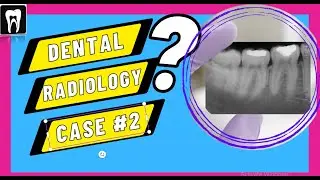 Dental radiology Case 2 | Radiographic Interpretation | DENTAL CASE DISCUSSION