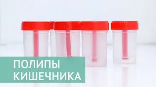 Полипы кишечника