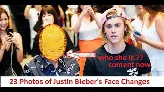 23 Photos of Justin Bieber's Face Changes + Lifestyle in 2018