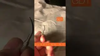 Уз насадки
