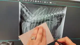 How to do a VHS (vertebral heart score)