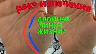 Рак, излечение. Тонула в детстве. Двойная линия жизни - это одни проблемы? хиромантия