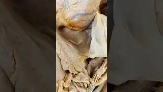 Look At What the Heart Is In!