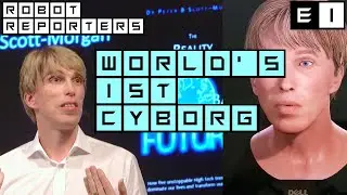 PETER 2.0: World's first full cyborg, Dr Peter Scott-Morgan - Episode #1
