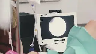 Nejmenší hysteroskop na světě