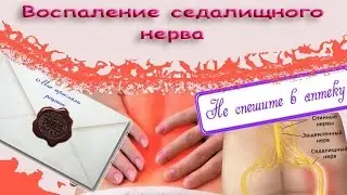 Воспаление седалищного нерва. Мое лечение. Мне пришло письмо