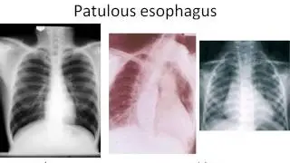 Webinar: Systemic Sclerosis, a Treatable Multi-System Disease, with Dr. Monique Hinchcliff (2012)