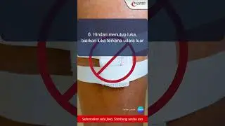 PART 2 - CARA MENGATASI SENGATAN HEWAN LAUT (UBUR-UBUR / BULU BABI) #shorts #marine #beritaterkini
