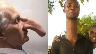 Bu Adamın Orası Boyundan Daha Büyük!! Normalden Daha Büyük Vücut Uzuvlarına Sahip Kişiler