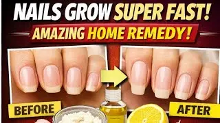 I Tried These 5 Nail Hacks & My Nails Grew Shockingly Fast 😱💅 | Fast Nail Growth Tips
