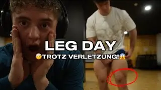 LEG DAY mit VERLETZUNG!🤕 | Leg Day