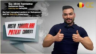 🇹🇷👏🏻Saç ekimi hastamız Muhammet Bey'in, #saçekim işlemine dair tüm süreci.