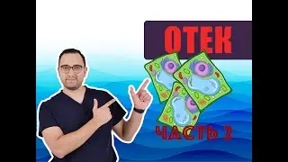 ОТЕК | Патологическая физиология ЧАСТЬ 2